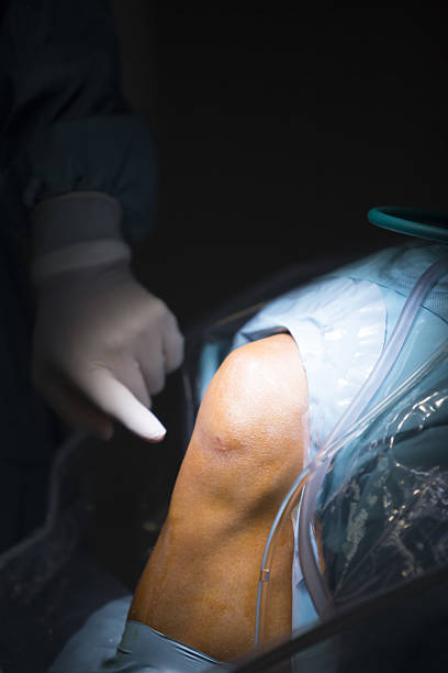 Knee arthroplasty symposium.
